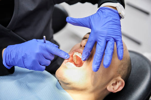 Best Emergency Treatment for Dental Infections or Abscesses in Rio Del Mar, CA